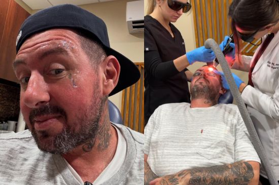 Brian Wenning Removes Face Tattoos