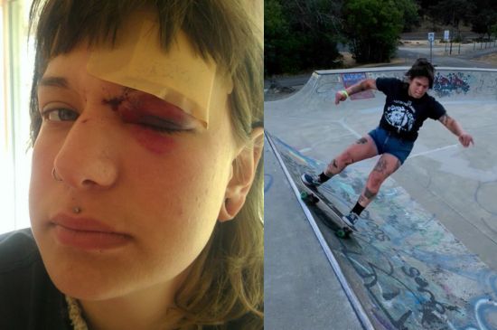 [News] Skater Girl Liz Wilson Speaks Out About Alleged Abuse by Well-Known Skateboarder