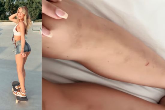 [News] Pro Skater Sterre Meijer Gets Called an AI Skater, Shows Her Bruises to Prove the Haters Wrong