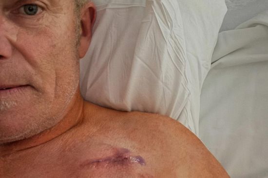 Skate Legend Dave Hegstrom Fighting Back After Heart Failure