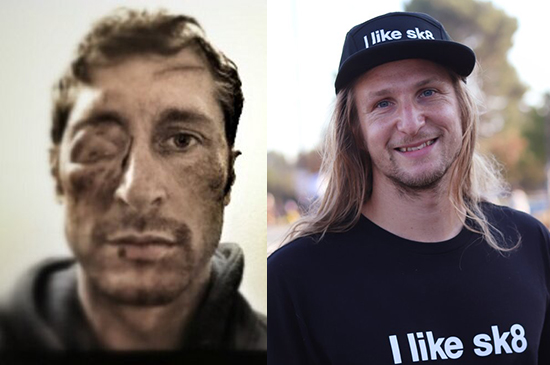 Steve Berra vs Ricky Glaser