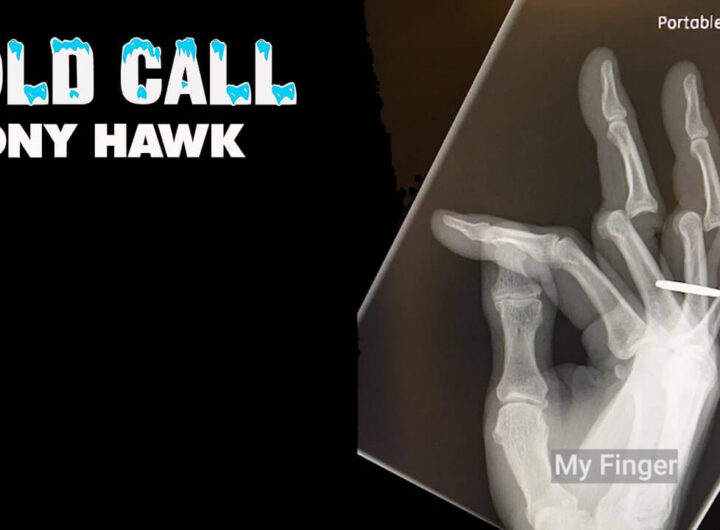 Tony Hawk Cold Call