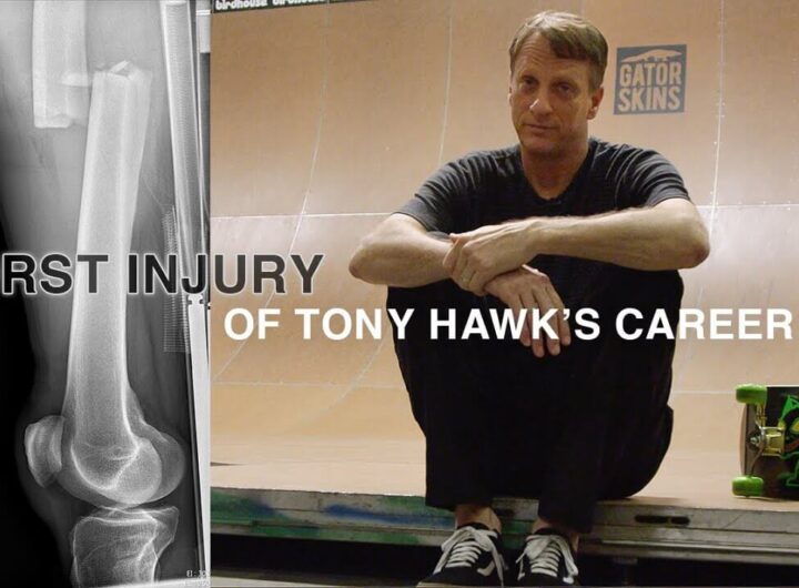 Tony Hawk on injuries